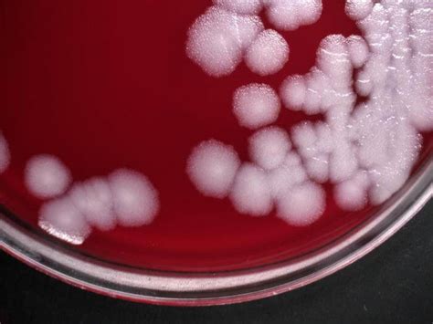 Bacillus anthracis- An Overview