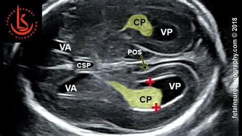 Fetal Ultrasound Anatomy - Anatomical Charts & Posters