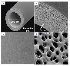 Polysulfone Membrane In Dialyzers - GetMedEasy