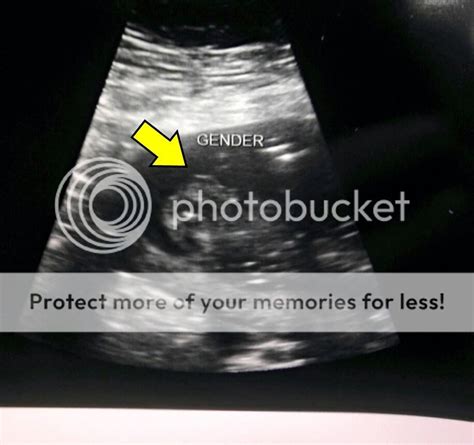 19 weeks anatomy scan - BabyCenter