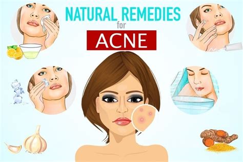 6 Of The Best Natural Remedies For Acne That Work - Fitneass