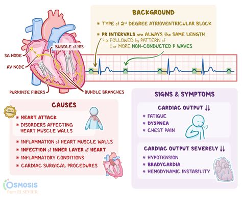 What Causes Complete Av Block: Unraveling The Mystery