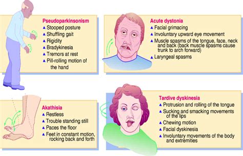 extrapyramidal symptoms - Google Search | Pharmacology nursing, Psych ...