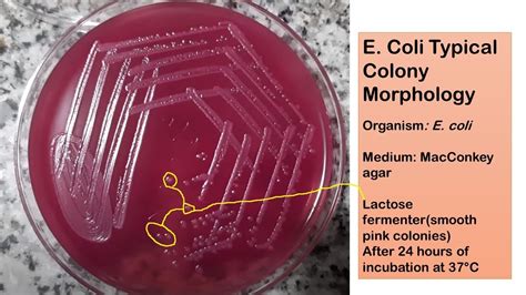 E Coli Typical Colony Morphology On Macconkey Agar Youtube | Free Nude ...