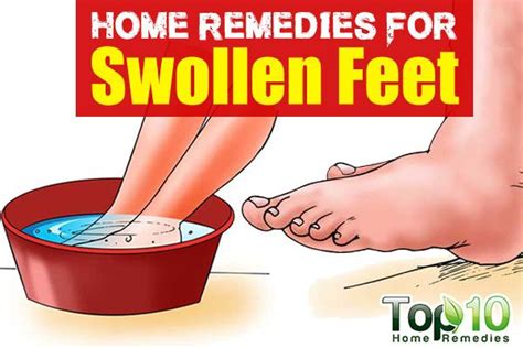 Home Remedies for Swollen Feet | Top 10 Home Remedies