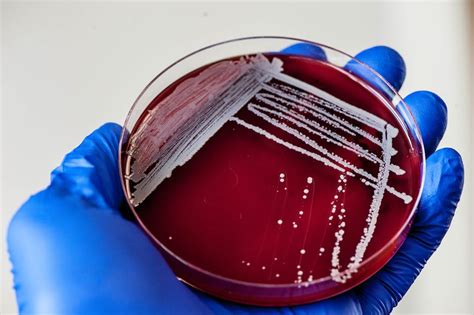 Staphylococcus Aureus On Blood Agar Plate