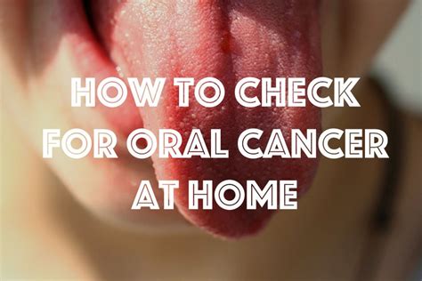 How to Check for Mouth Cancer at Home | HealDove