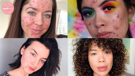 6 Bloggers Talk To Teen Vogue About Their Acne Journeys | Teen Vogue