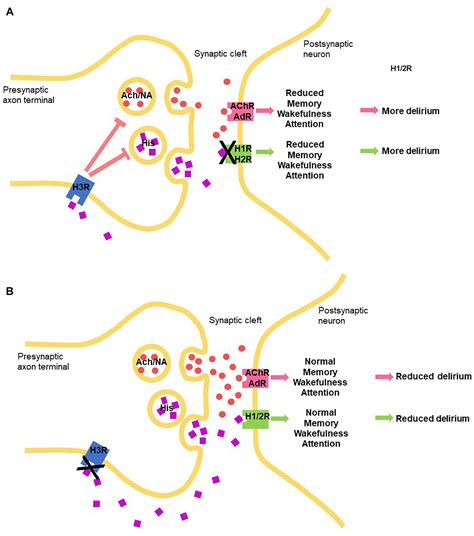 Frontiers | Histamine and Delirium: Current Opinion