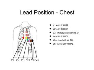 Lead Placement For Posterior ECG – Resus Review, 42% OFF