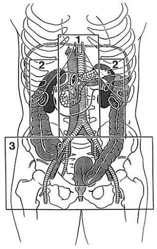 急診夜未眠: Traumatic Retroperitoneal Hematoma