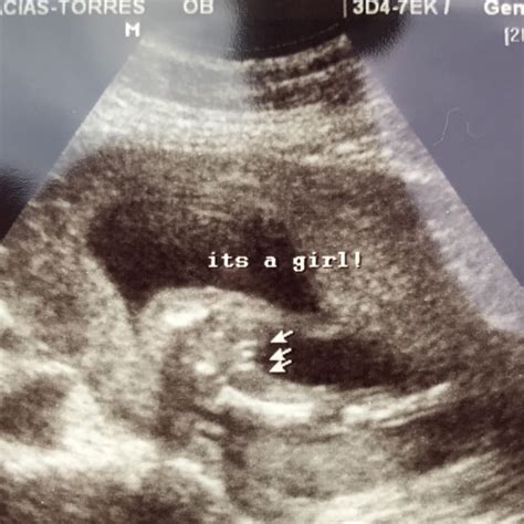 Had my 17 week ultrasound, tech says it's a girl! Could it possibly be ...