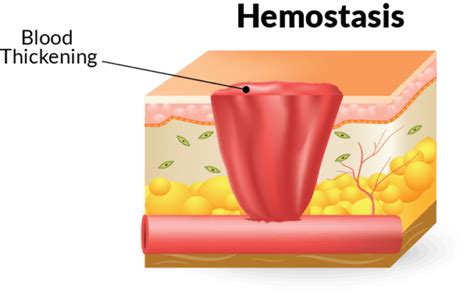 The Four Stages of Wound Healing and How to Treat Them—Home Care Delivered