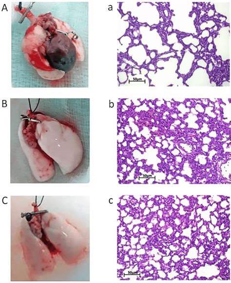 A/a: PEEP 2; B/b: PEEP 5; C/c: PEEP 10. Inflated lungs are smaller in A ...