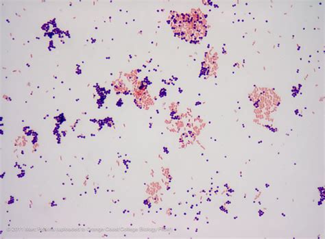 Gallery For > Staphylococcus Epidermidis 1000x