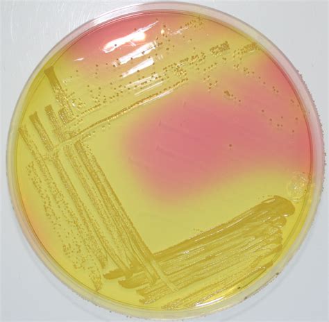 Staphylococcus aureus (S. aureus) - Aladdin Creations