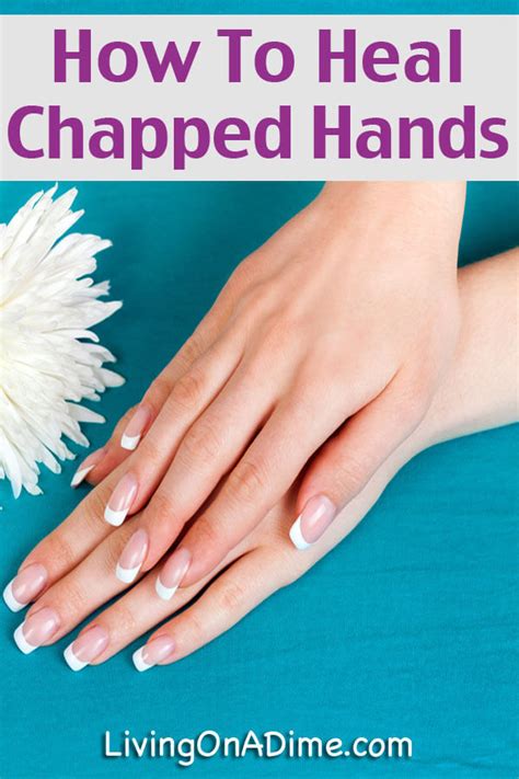 How To Heal Chapped Hands - Natural Recipe For Winter Dry Skin - Living ...