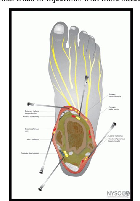 Saphenous Nerve Ankle