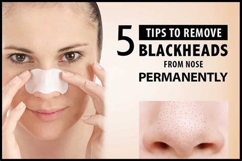 How To Permanently Remove Blackheads From Your Nose - HOWOTRE