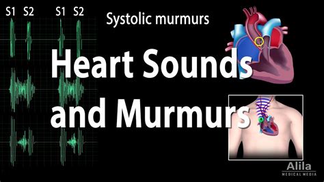 Heart Murmur Sounds | Faculty of Medicine