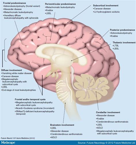 Advances in the Diagnosis of Leukodystrophies