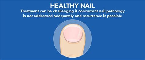 Pseudomonas aeruginosa Test for Green Nail Syndrome - Bako Diagnostics