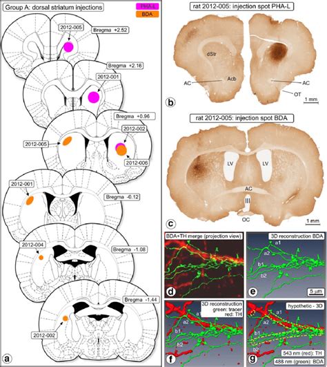 Dorsal Striatum