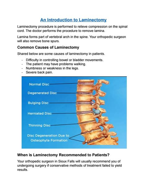 An introduction to laminectomy procedure by Harry Llioyd - Issuu