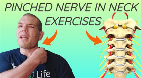 Pinched Nerve In Neck Exercises | Relieve Pinched Nerve Pain