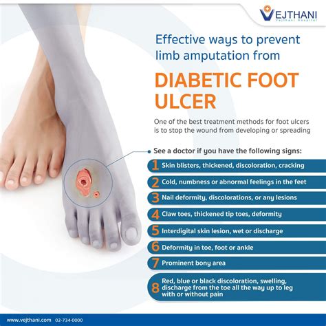 Early treatment reduces the chance of Foot Ulcer infection