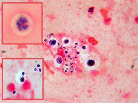 Fun With Microbiology (What's Buggin' You?): Cryptococcus neoformans