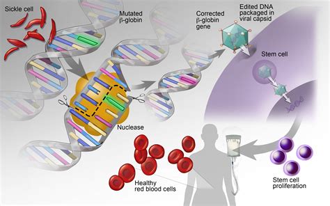 Sickle-cell, Gene Fixes, and Health Justice – The Chief Organizer Blog