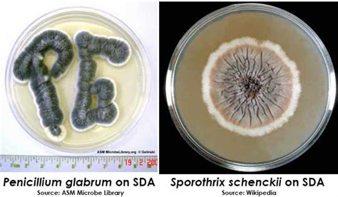 Sabouraud agar - Alchetron, The Free Social Encyclopedia