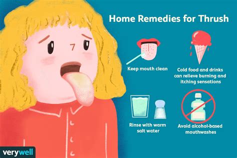 How Thrush Is Treated in the Mouth