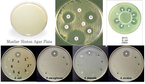 Mueller Hinton Agar (MHA) – Composition, Principle, Uses and Preparation