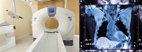 Computed Tomography (CT) Medical X-Ray Imaging | Open Medscience