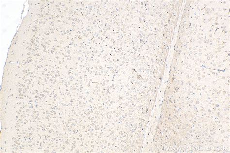 Caspase 3 antibody (82202-1-RR) | Proteintech