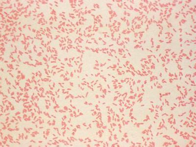 Enterobacter Aerogenes Gram Stain