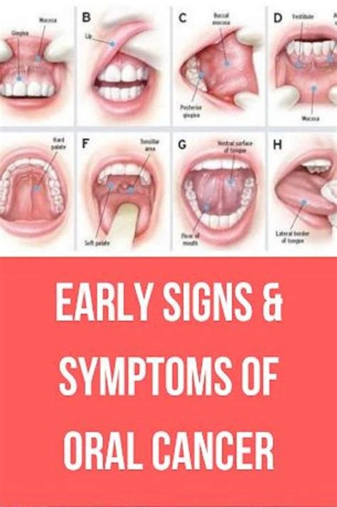 Oral Cancer Symptoms: 7 Signs You Should Never Ignore | Wellness True