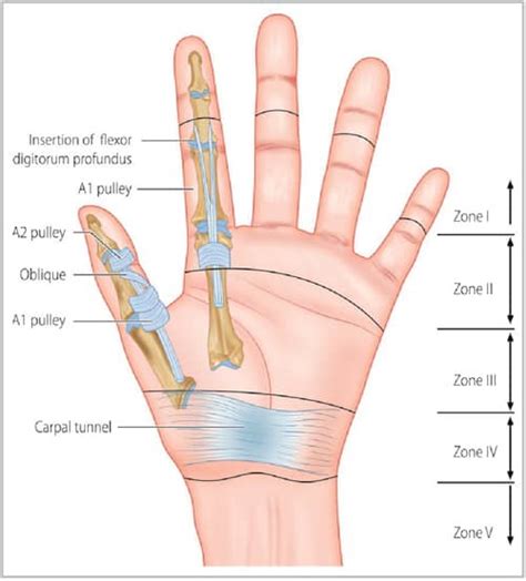 Pulley Injuries Caused From Rock Climbing - Ascent Health & Sport Therapy