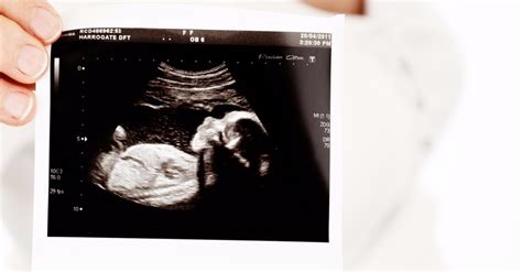 'Babies in the Womb': NBC's Today Surprises Pro-Lifers with 3D ...