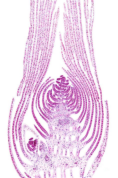 Apical bud of an aquatic plant, longitudinal section, 20X light ...