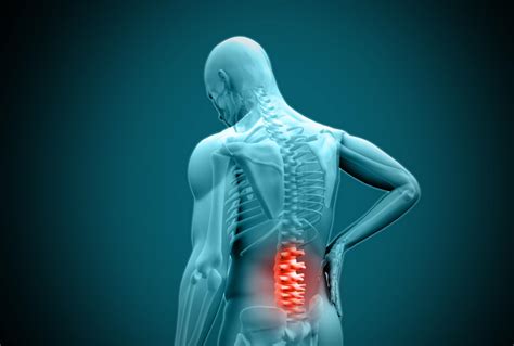 Post-Laminectomy Syndrome