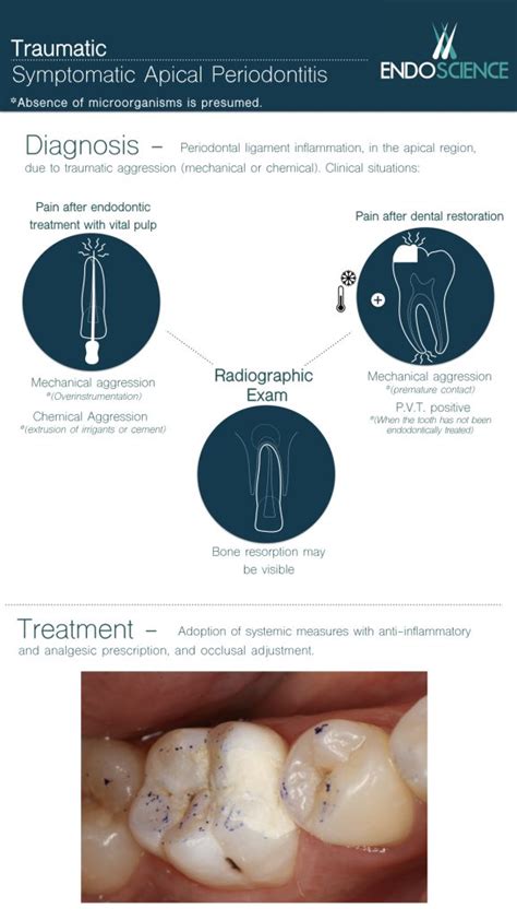 Symptomatic Apical Periodontitis of traumatic origin | Endoscience