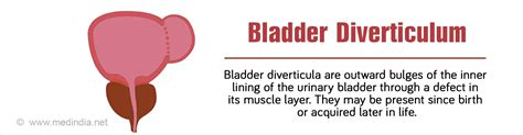 Bladder Diverticulum - Causes, Symptoms, Diagnosis and Management