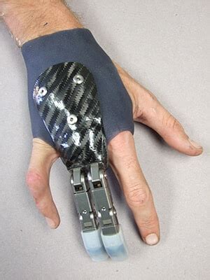 Somatic - Finger & Hand Prosthetics – Medical Art Prosthetics