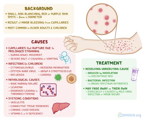 Petechiae: What Is It, Causes, Treatment, and More | Osmosis