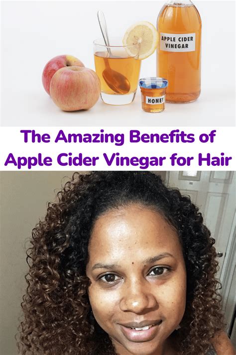 Discover the Amazing Benefits of Using Apple Cider Vinegar for Hair