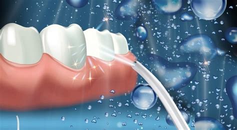 Water Flossers aka Oral Irrigators: Nicole Mermet, DMD: Dentist