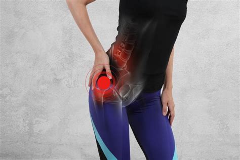 Gluteal Tendinopathy Treatment - Thrive Physio Plus